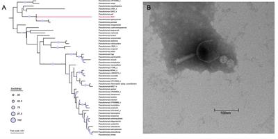 Characterization and genomic Analysis of a novel Pseudomonas phage vB_PsaP_M1, representing a new viral family, Psaeviridae